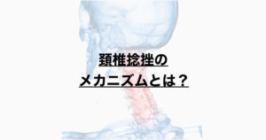 頚椎捻挫のメカニズムとは？